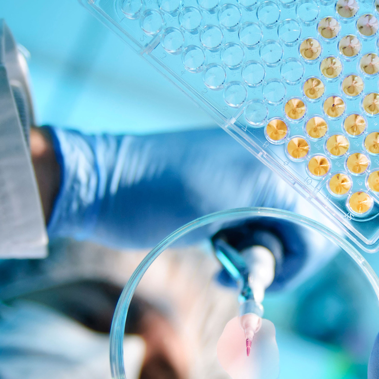 Ein Artzt mit blauen Handschuhen arbeitet mit einer Pipette und einer Mikrotiterplatte